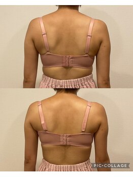 アネラ 京都駅前店(Anela)/【背中スッキリ☆】