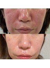 アイクイーン 亀戸(Eyequeen)/