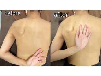 ひかる接骨院 ひかるボディケア