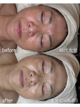 フロル(FLOR)/FLOR【根本改善専門店】