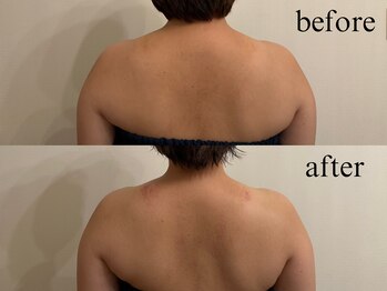 フウ(fuu.)/肩こり改善