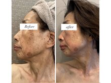 アリィ(Alii)/60代半年で10歳若見え！