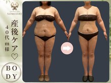 サムデイ プレミアム 新宿西口店(SOMEDAY)/BODY