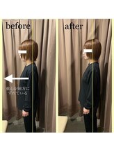 アイリー(Irie)/骨格矯正