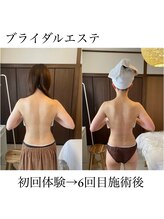 イム(I'm.)/ブライダルエステ &nbsp;before/after