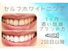 セルフホワイトニング【1ヶ月通い放題の方】¥0