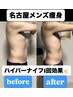 【当日限定】お腹集中引き締め徹底ケア◎ハイパーナイフ1部位 30分 ¥4400