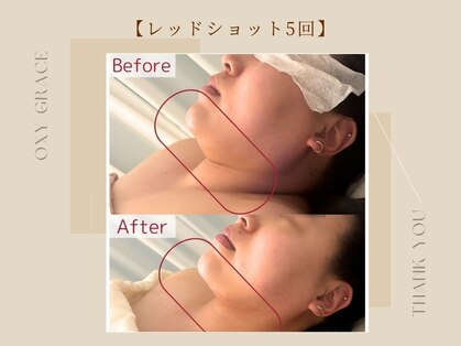オキシー グレイス 小倉店(OXY Grace)の写真