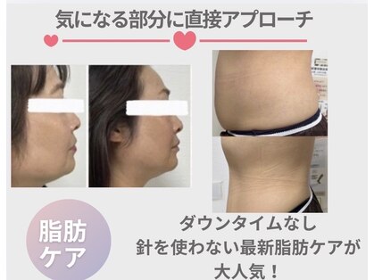 リタプレイス 琴似(LITAPLACE)の写真