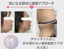 リタプレイス 琴似(LITAPLACE)