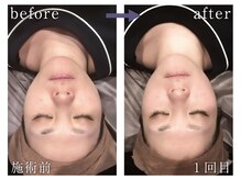 チル 渋谷店(CHILL)の雰囲気（【カラダ整う】お悩みを根本改善し、顔もお尻も小さく立体的に！）