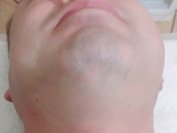 ブラジリアンワックス脱毛サロン リアンジュ(Rienge)/メンズヒゲ脱毛