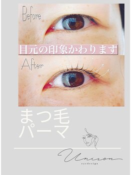 ユニゾン(Unison)/