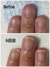 お客様のビフォーアフター写真