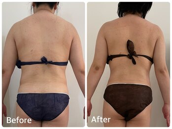 ナビ(NABI)/見た目年齢!-5歳も夢じゃない♪