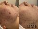 ライム 立川(LIME)の写真