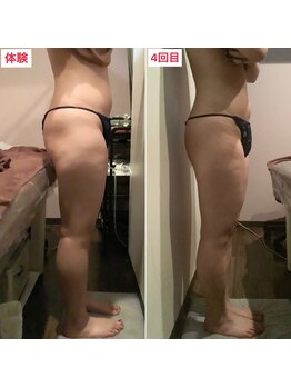 ビタミンスパ 中野店/お腹-3cmダウン★施術回数4回