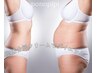【脂肪分解クリーム気になる贅肉徹底ケア★】全身痩身コース所要時間130分