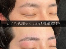 ユー 千葉駅前店(you)/ビフォーアフター写真