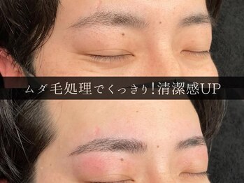 ユー 千葉駅前店(you)/ビフォーアフター写真