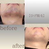 サロン コア(salon koa)