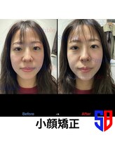 ストレッチブル 根津店(Stretchble)/小顔ストレッチ