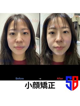 ストレッチブル 根津店(Stretchble)/小顔ストレッチ