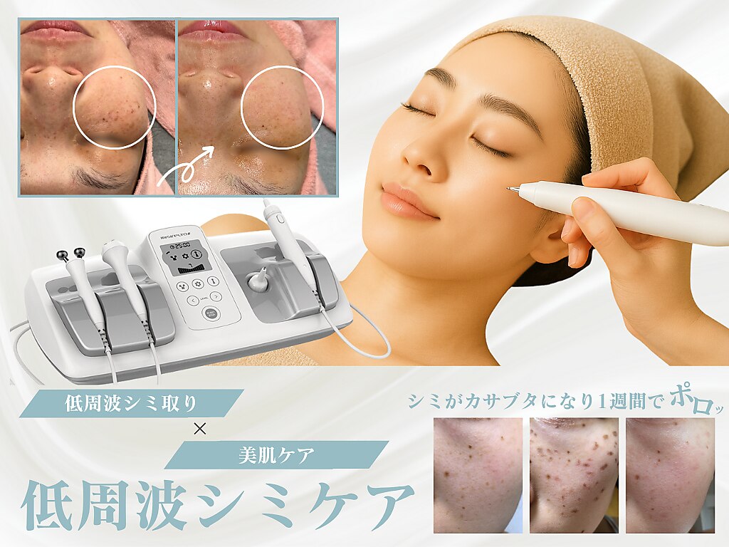 ✨️低周波顔シミ取りエステ✨️人気商品✨️即日発送 ベストベル(BestBelle)｜ホットペッパービューティー