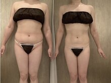 ラズリ(Lazuli)/3MAX 60min