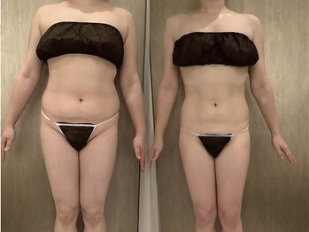 ラズリ(Lazuli)/3MAX 60min