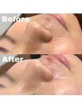 ナインオブカップス(9 of cups)/フェイシャルWaxで艶肌！