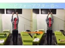 ケアるら整骨院 富里院/ビフォーアフター