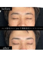 ユー 千葉駅前店(you)/ビフォ－アフター写真