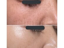 シャリール(charire)の雰囲気(プラペンでお肌を改善しませんか?臍帯100%は事前予約から可能!)