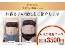 エバンス ノット(Evans knot)