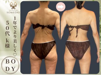 サムデイ プレミアム 新宿西口店(SOMEDAY)/BODY
