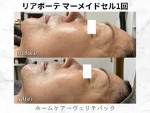 リライン(ReLine)/【マーメイドセル1回】