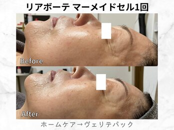 リライン(ReLine)/【マーメイドセル1回】