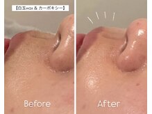 ウィズ(with)/カーボキシー×白玉WAX