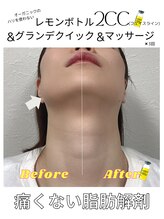 ラブニール 恵比寿店/【レモンボトル】