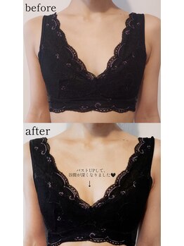 ブルーム(bluem)/長年の悩みに希望が！！！