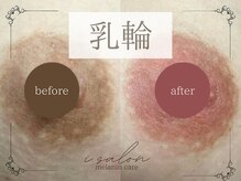 アイサロン(i.salon)の雰囲気(メラニンケア 乳輪)