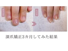 ローネイル(Raw nail)
