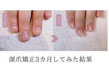 ローネイル(Raw nail)