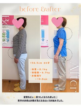 健康空間ルーナ/60代　156.5cm &nbsp;&nbsp;脂肪で落とそう