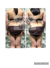 バイブスプラス(Vibes+)/