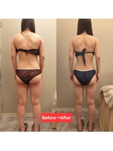 ラブリエ(Labriller)/当サロン自慢の痩身機器