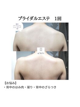 RiとBiのたまごの写真/19年の実績×オーダーメイド！挙式直前1Dayなどメニュー充実。自分史上最高の美しさで当日を迎えませんか？