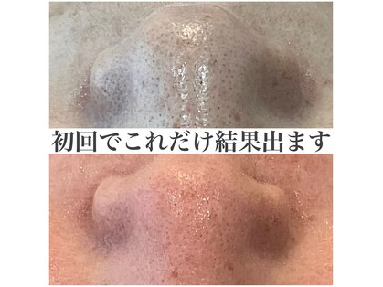 リアン Lienの写真
