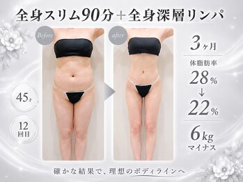 エモーション 横浜関内店(Emotion)の写真/【まだ、セルフで頑張りますか？】理想のボディラインになれる今年最後のチャンスです！